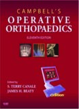 Campbell's Operative Orthopaedics: 4-Volume Set, 11th Edition  