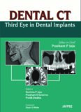 Dental CT: Third Eye in Dental Implants